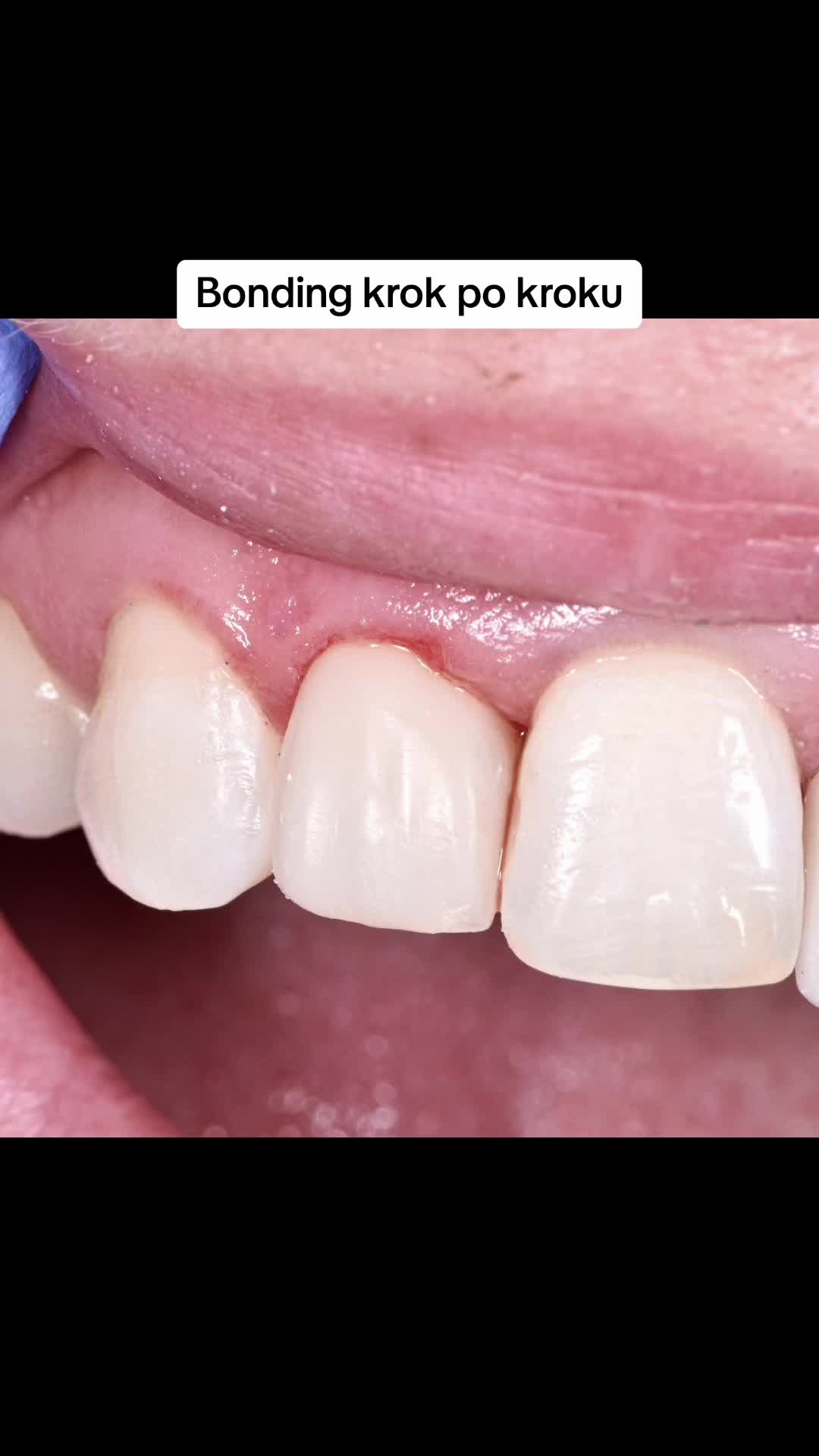 @Anna 🦷 dentystka