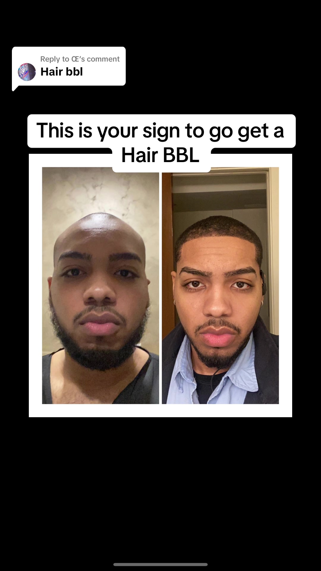 @theonlyacr