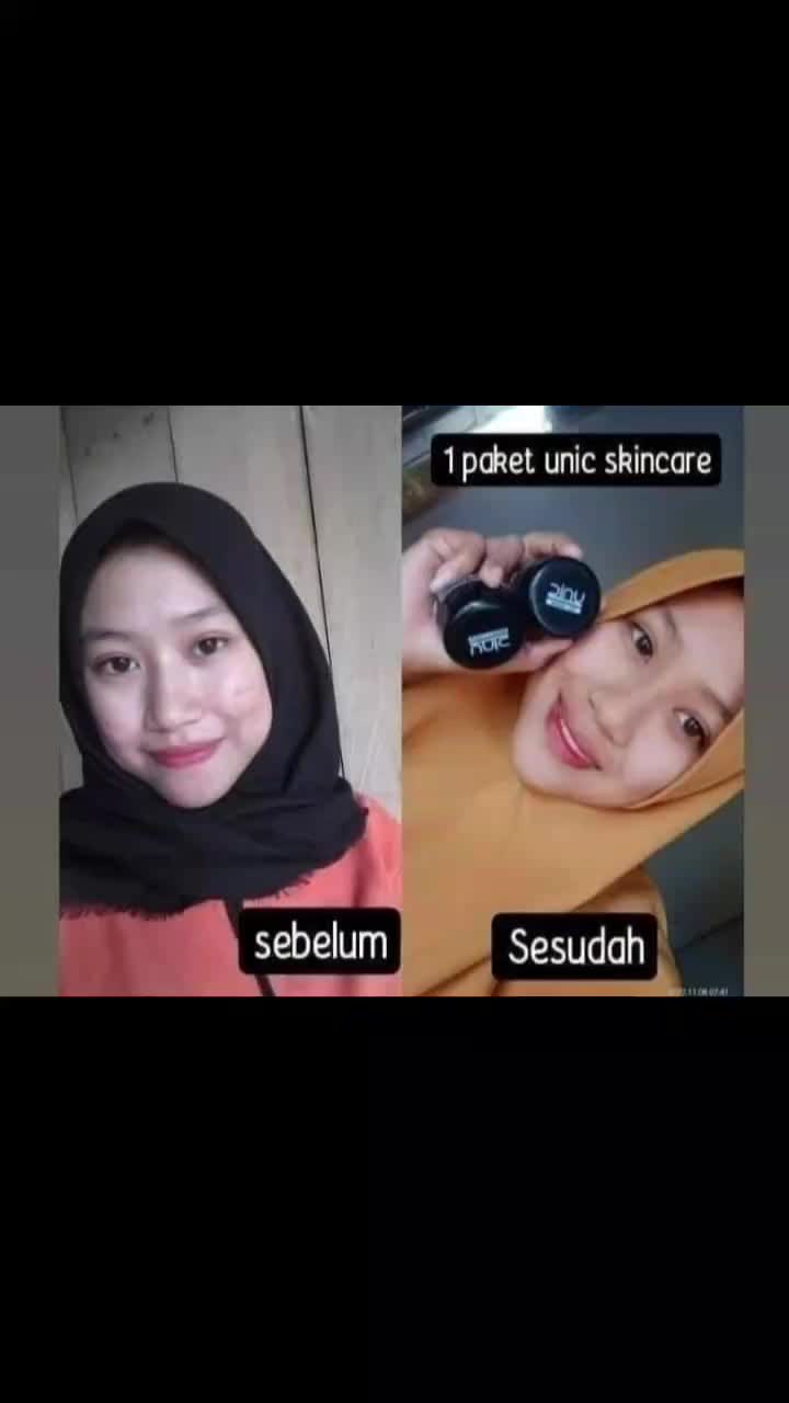 @Azmura_Store