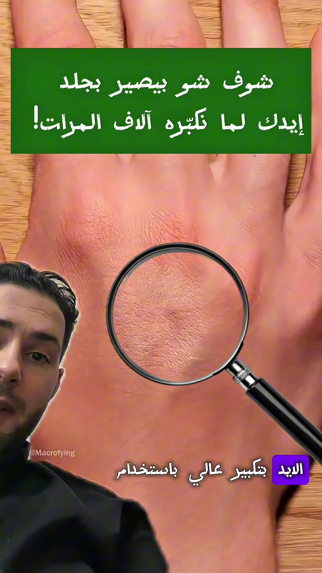 @طبيب تيك توك🩺💊💉