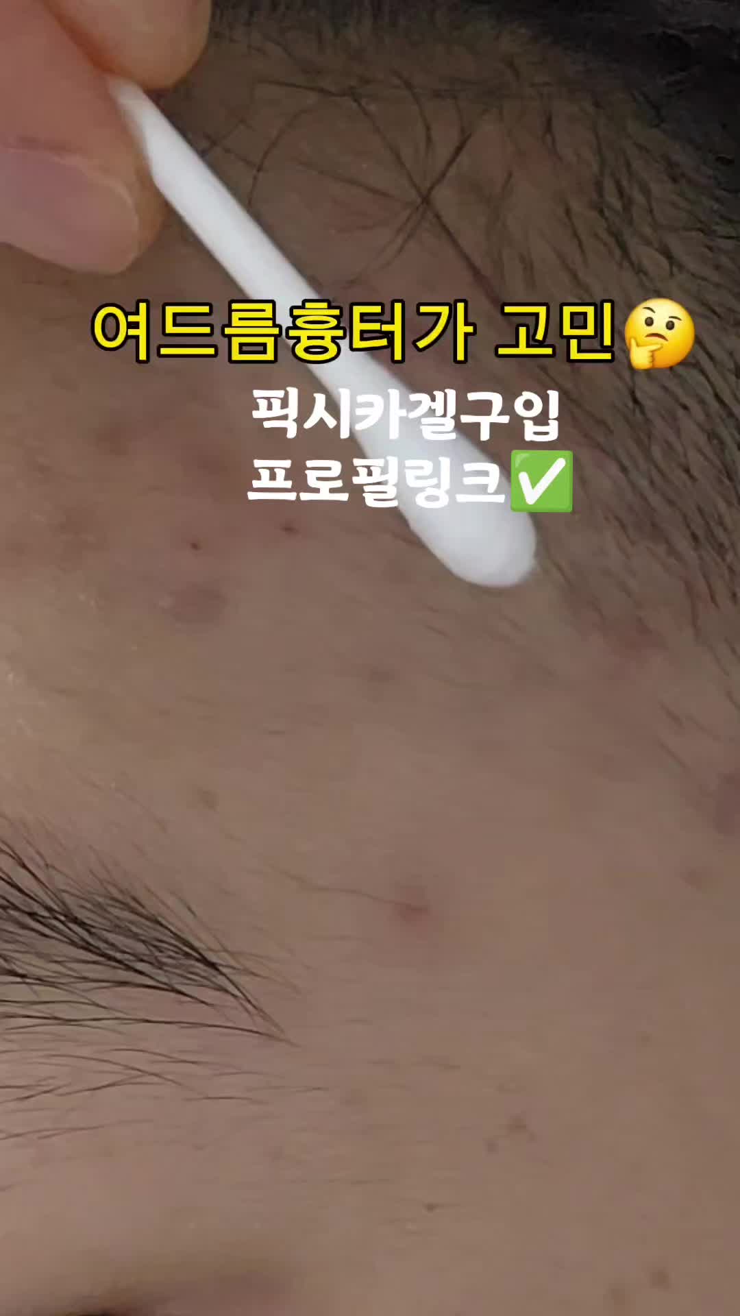 @더스파다운(여드름피부전문스파)