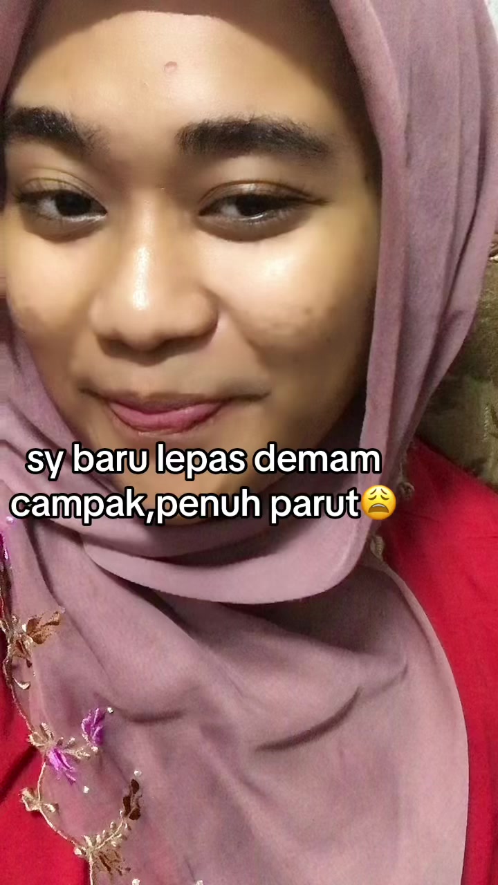 @Dik Alisya❗