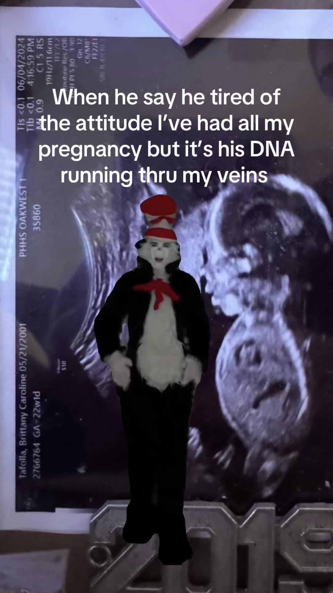 @Bribaby