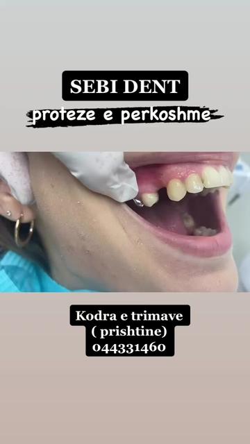 @sebi dent