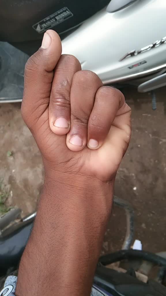@Aluri Vamsi
