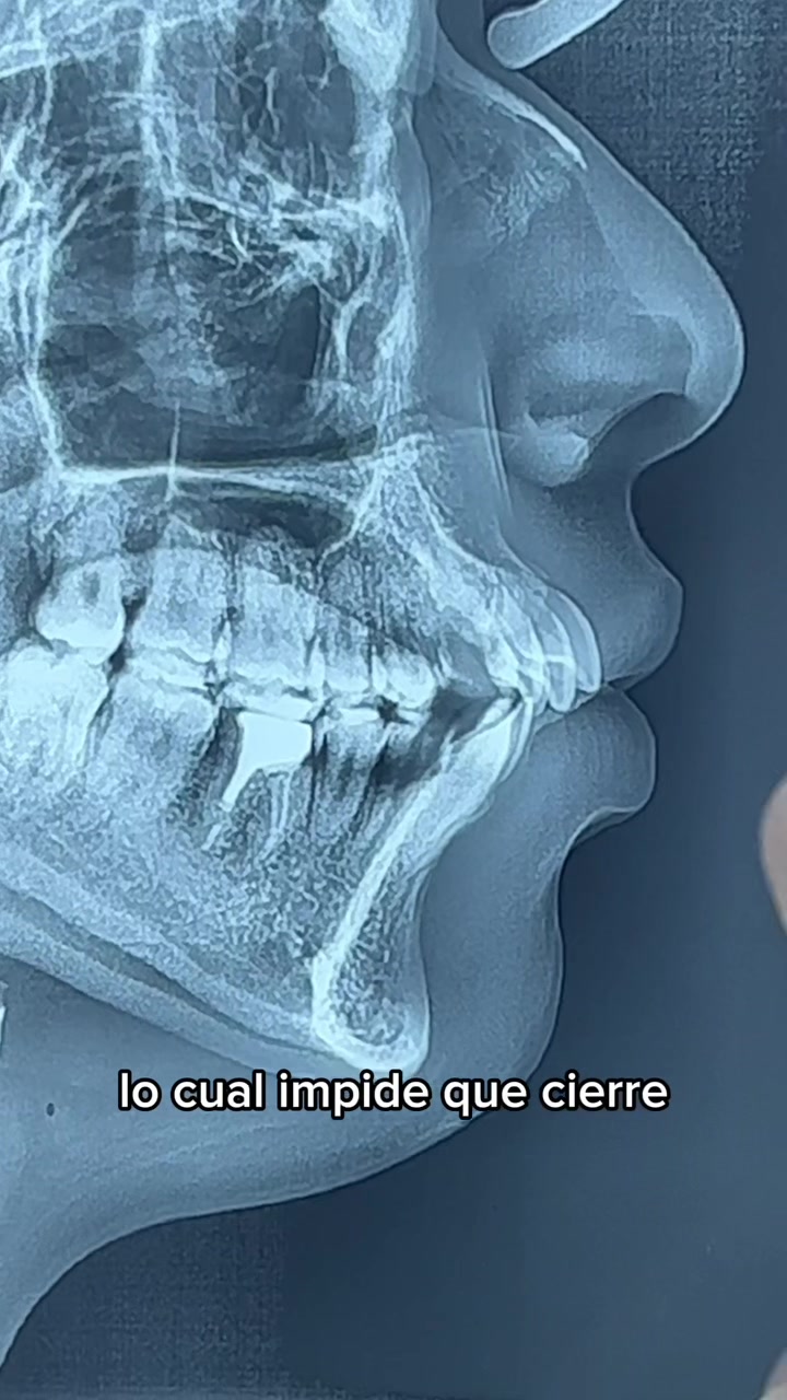 @DentikaBrackets