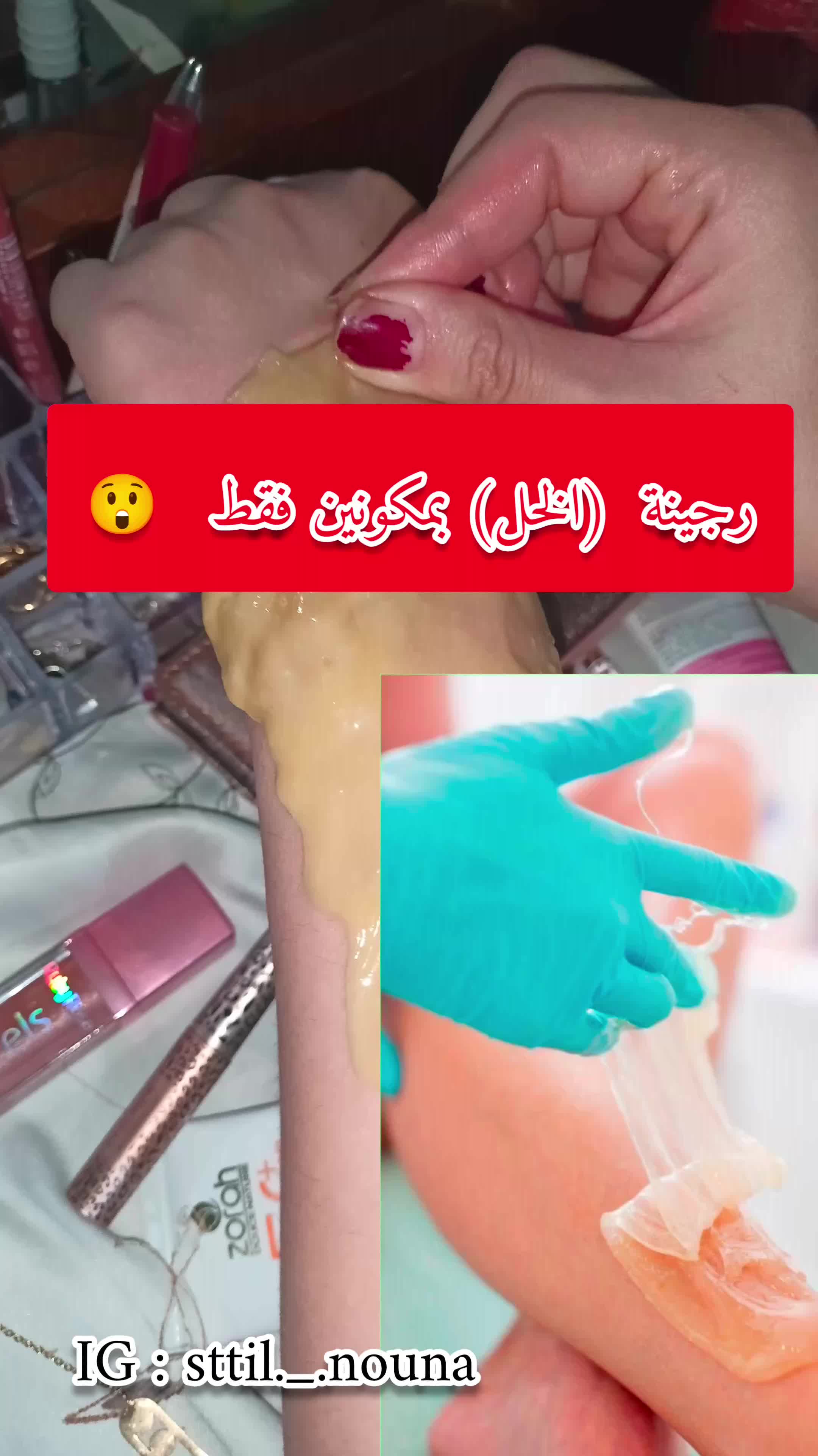 @still . Nouna