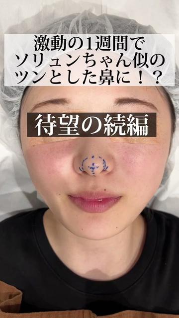 @イソセン/美容外科医（磯村亮輔院長）