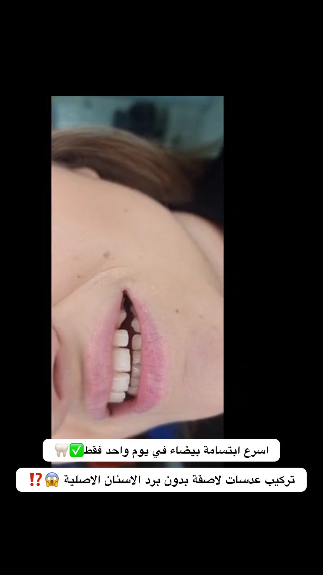 @brightsmileee1