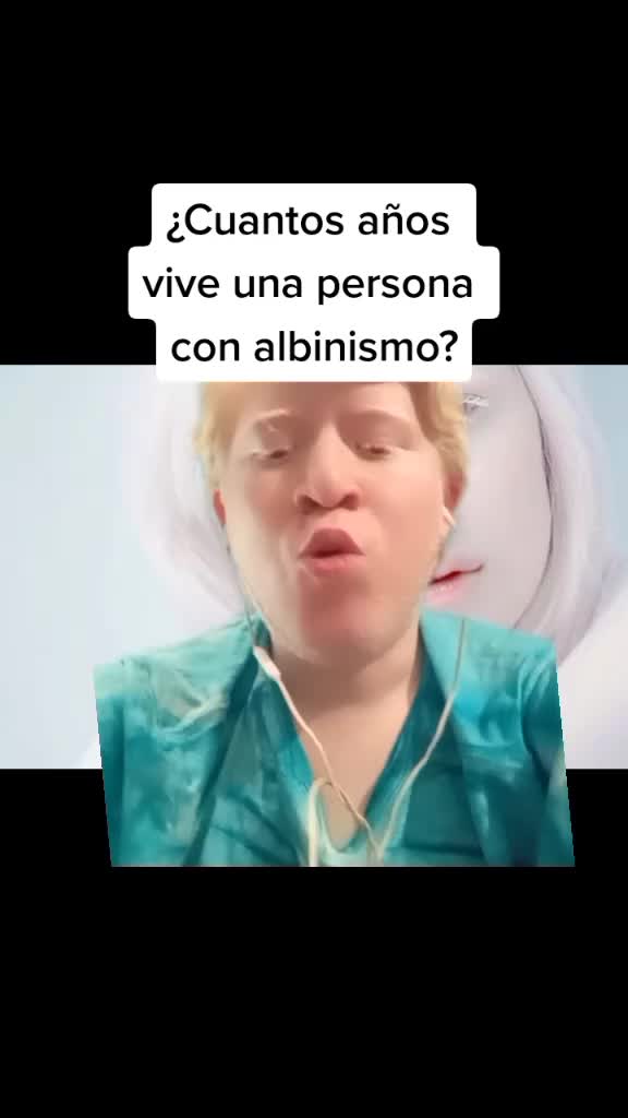 @ALBY