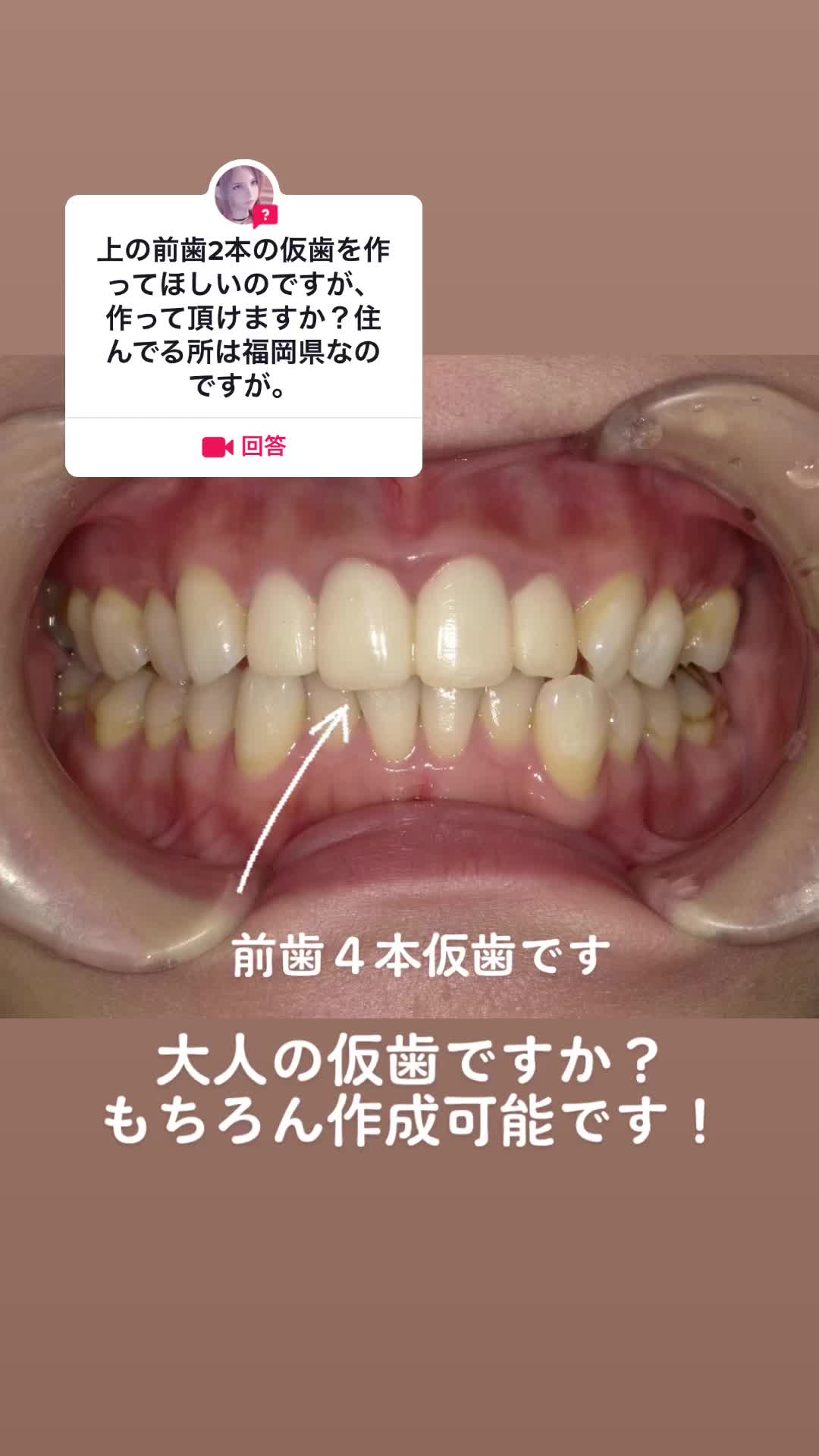 @DentalClinicPURE