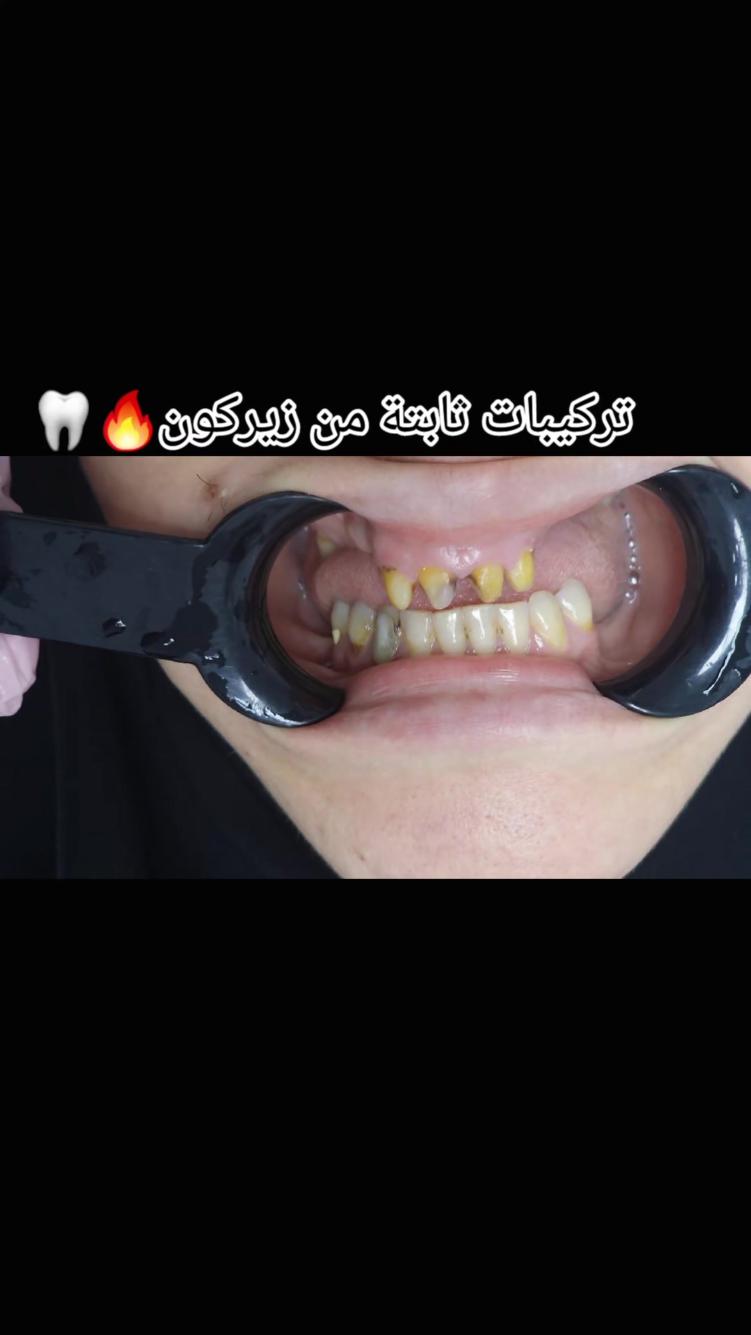@Dr otmani. A 🦷🖤