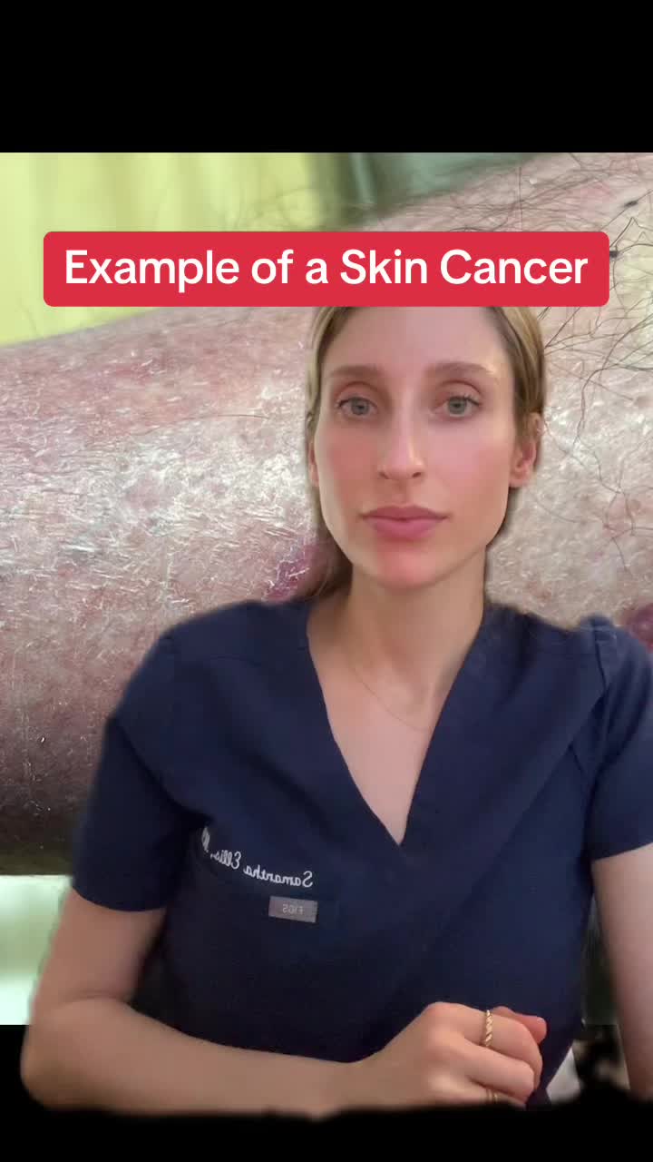 @Dr. Sam Ellis - Dermatologist
