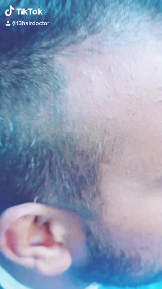 @13hairdoctor