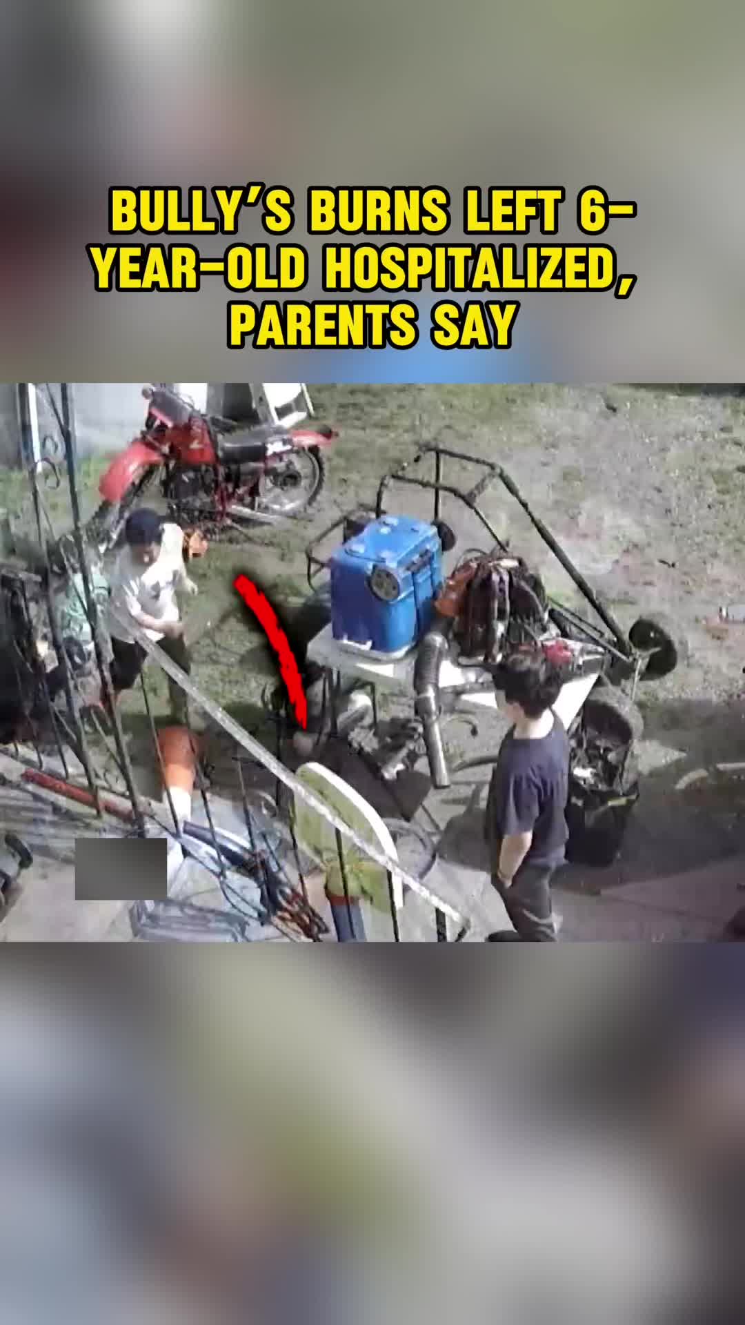 @BB story