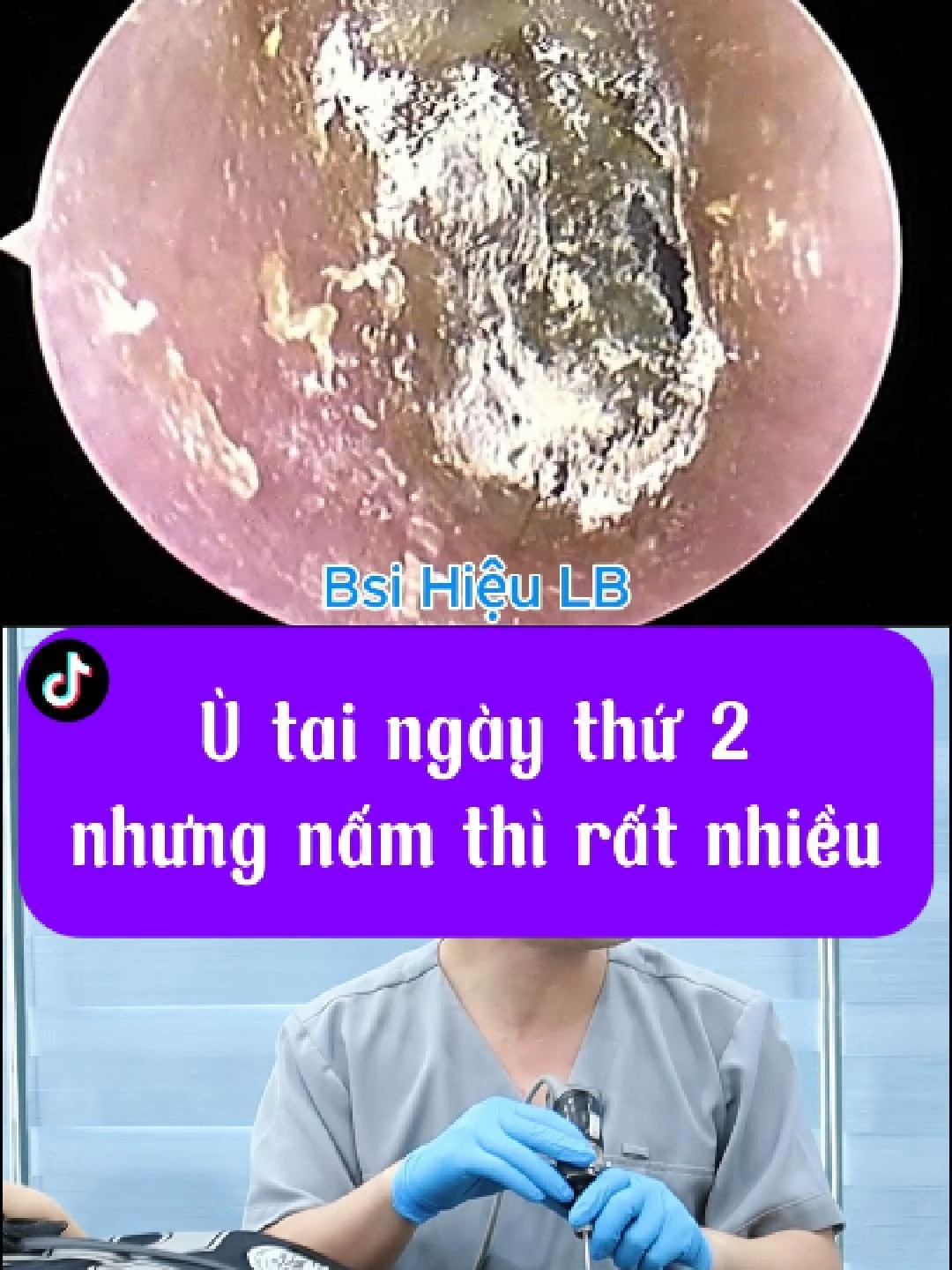@Bs Hiệu Tai Mũi Họng Long Biên