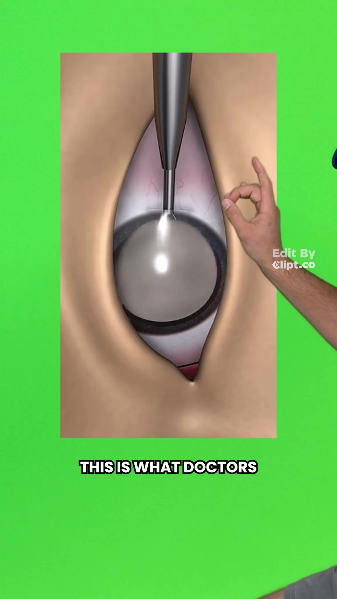 @smartnonsense