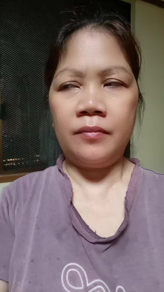 @Alma035