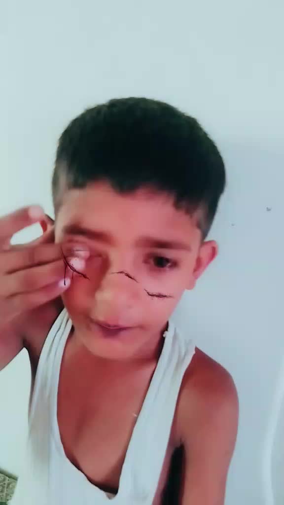 @Sameer saifi