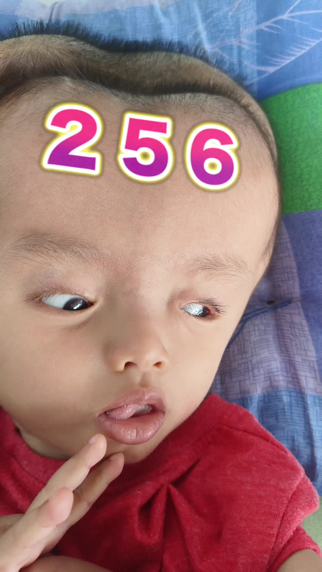 @บู้บี้เด็กหัวโตมีน้ำในโพรงสมอง