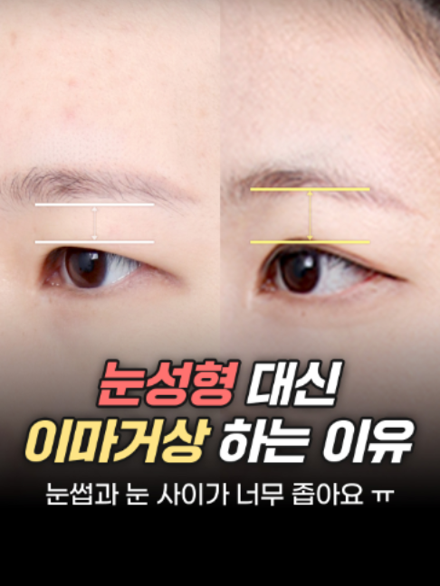 @디에이성형외과