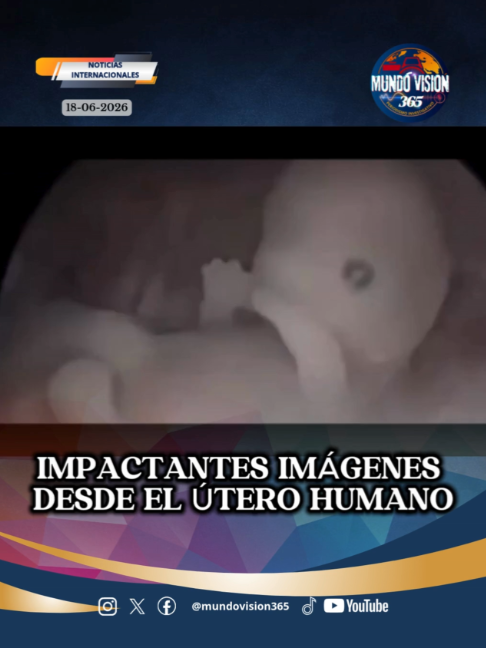 @MundoVision365