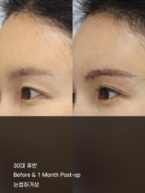 @다시피움성형외과 DASIPIUM タシピウム