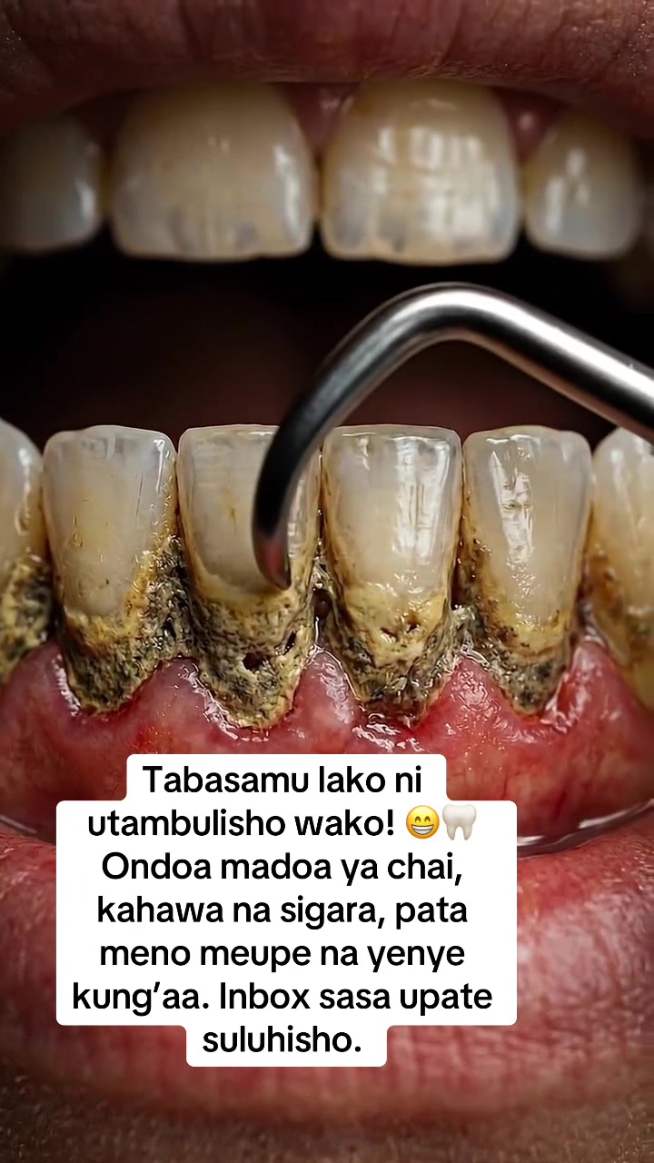 @Madam Zellah
