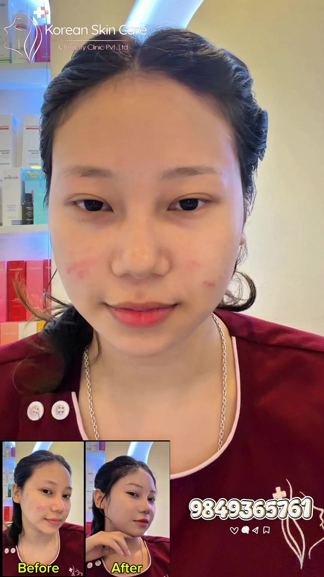 @Koreanbeautyclinic