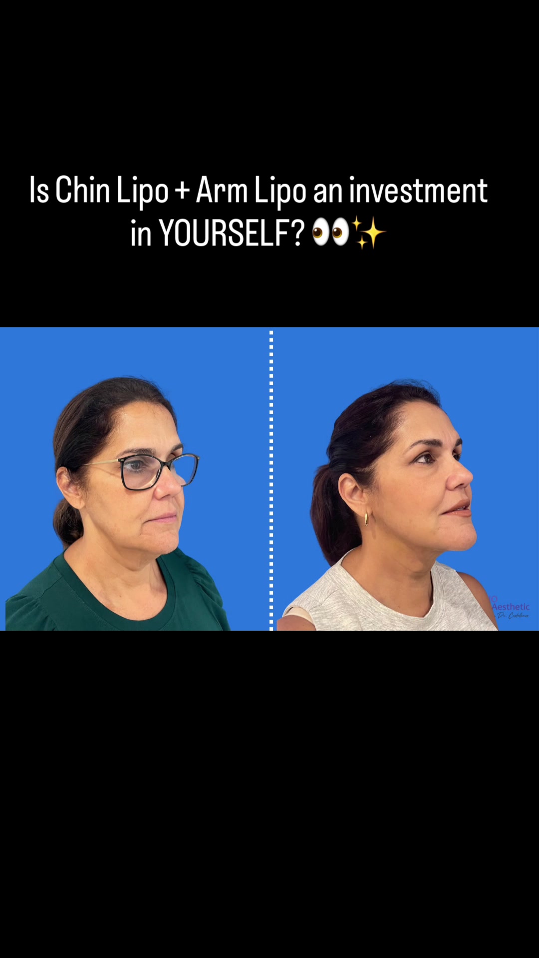 @BioAesthetic305