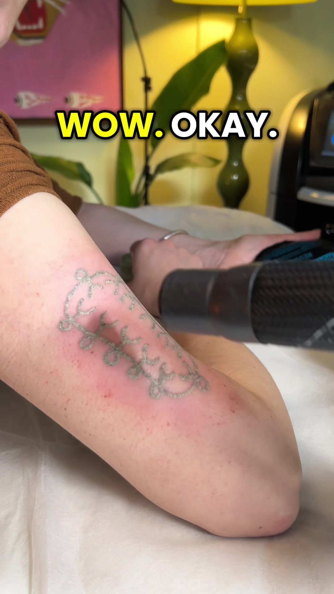 @Swift_tattoo_removal