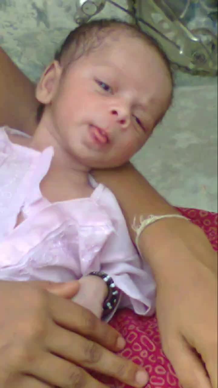 @Anchal