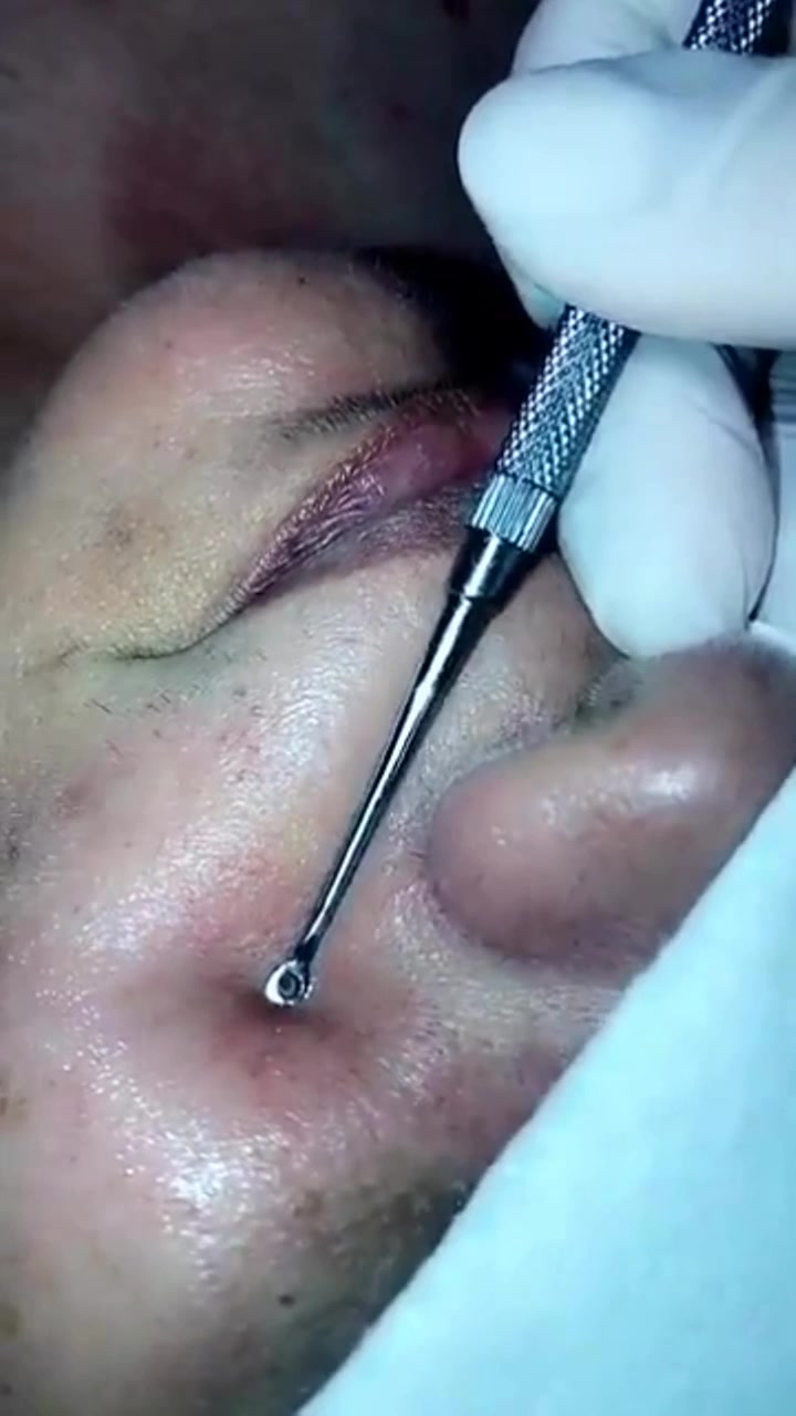 @crystal_clear_skin