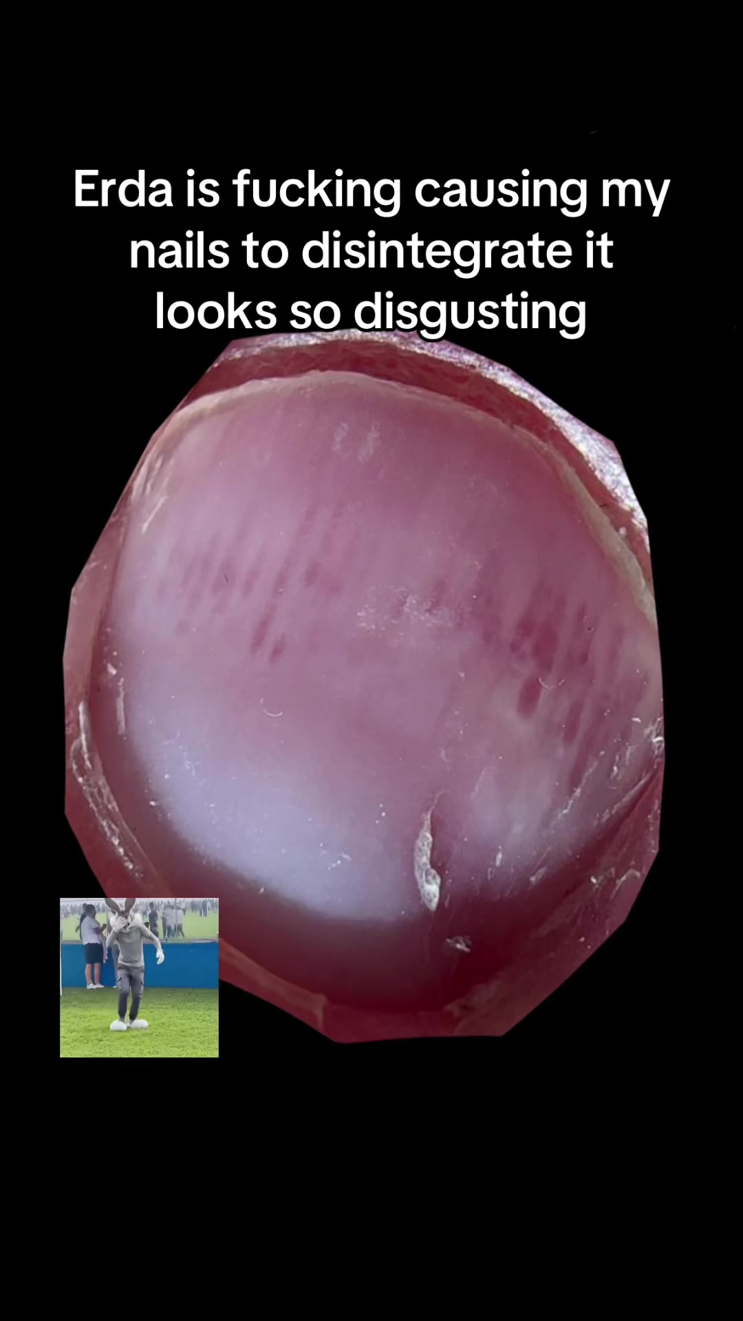 @skifee