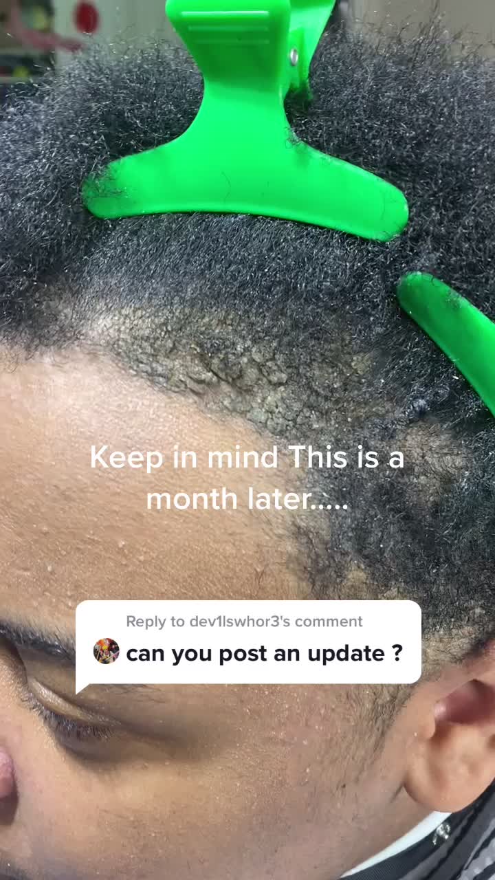 @Tip