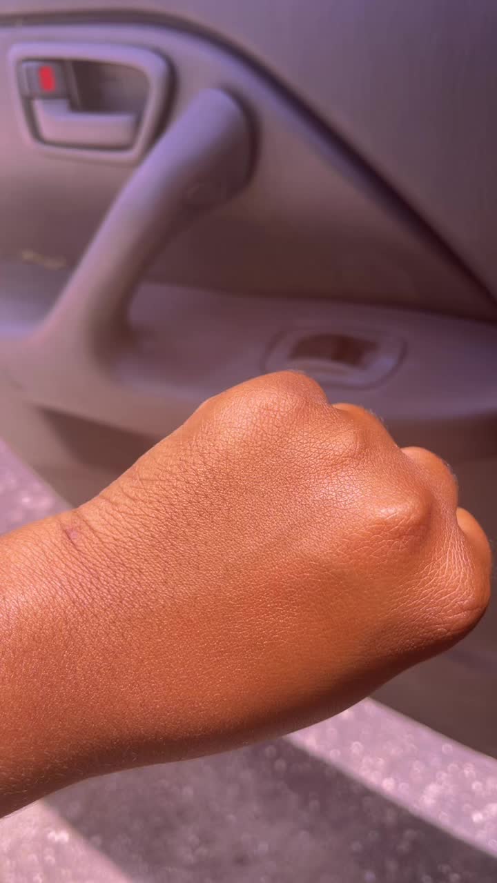 @braceface_redd29