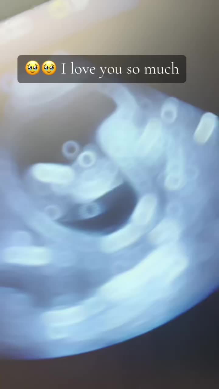 @Kristin + Baby ๐ถ๐ป๐ฉ๐ผ๐ผ