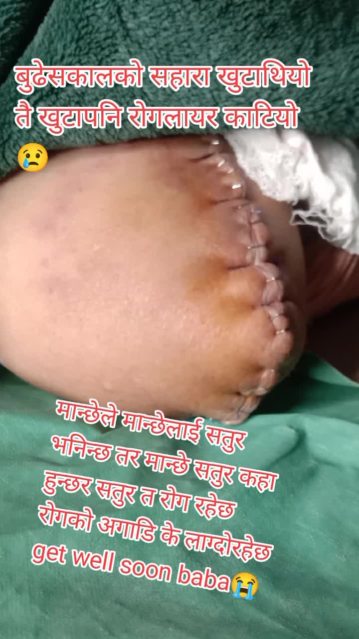 @Lila Poudel
