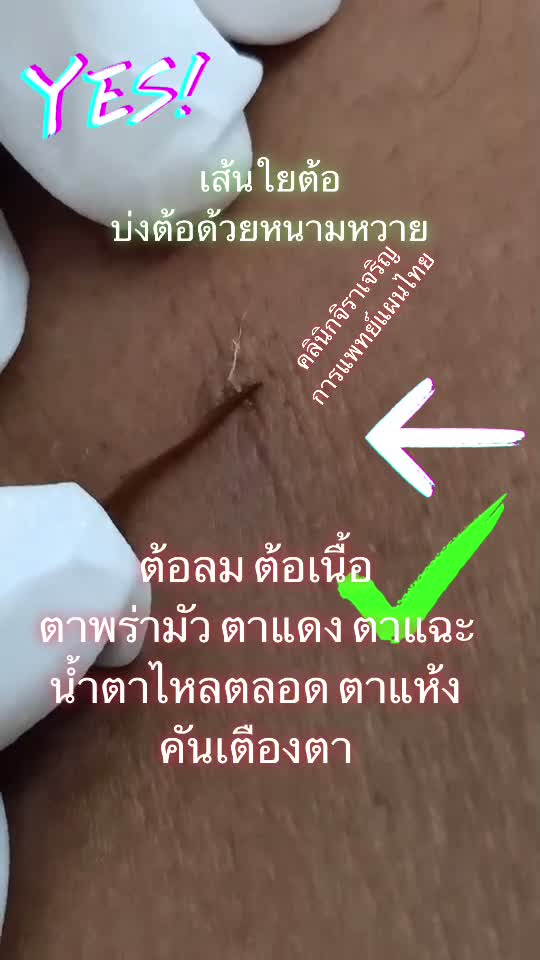 @หมอเชอร์รี่