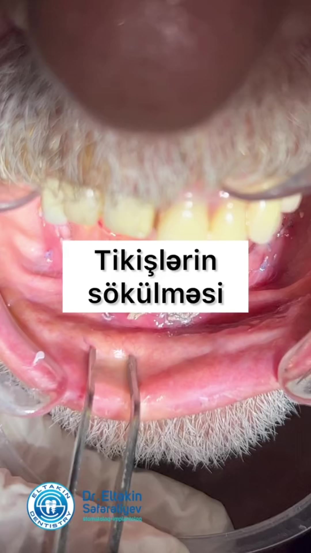 @eltakindentistry