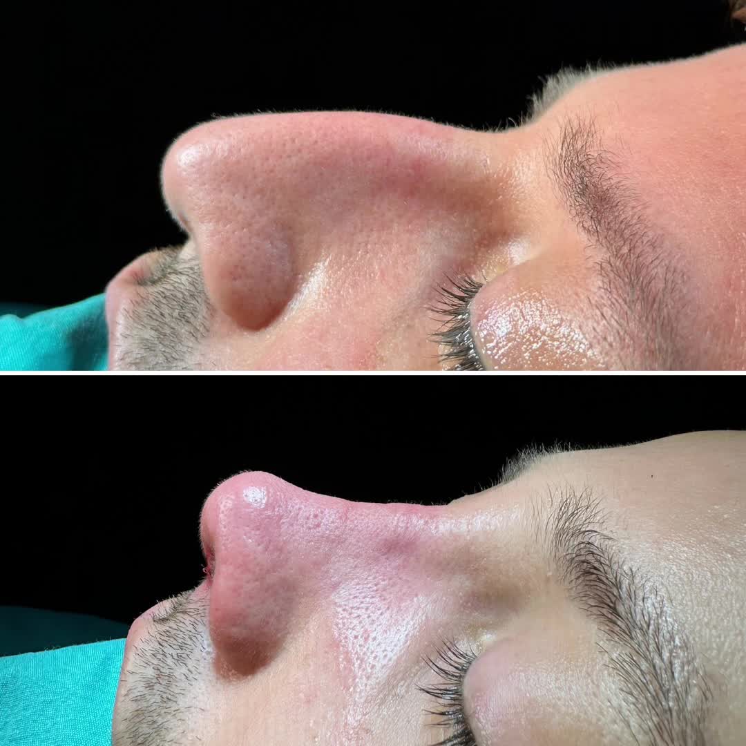 @Dr. NurtenKucuk