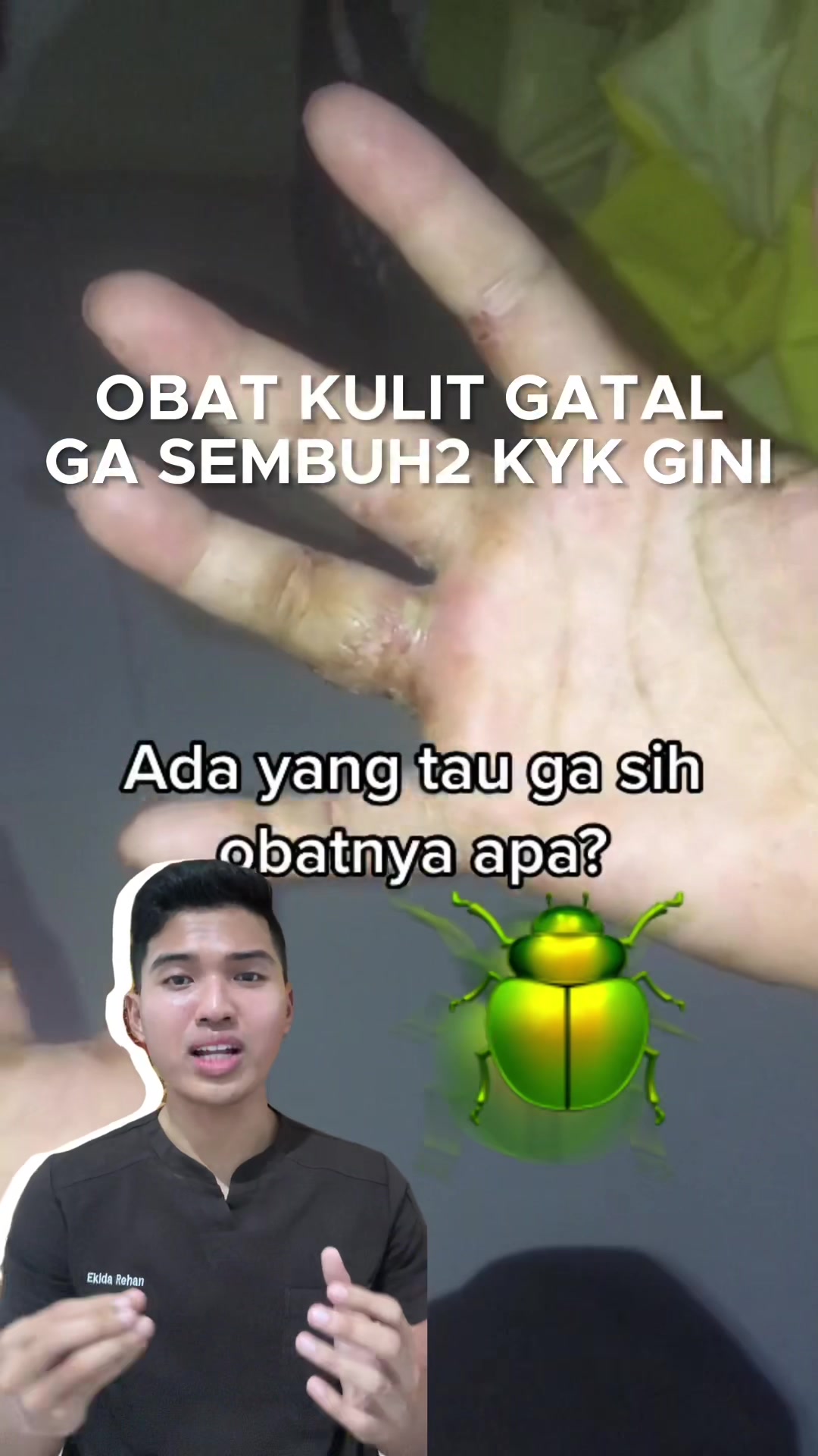 @Ekida