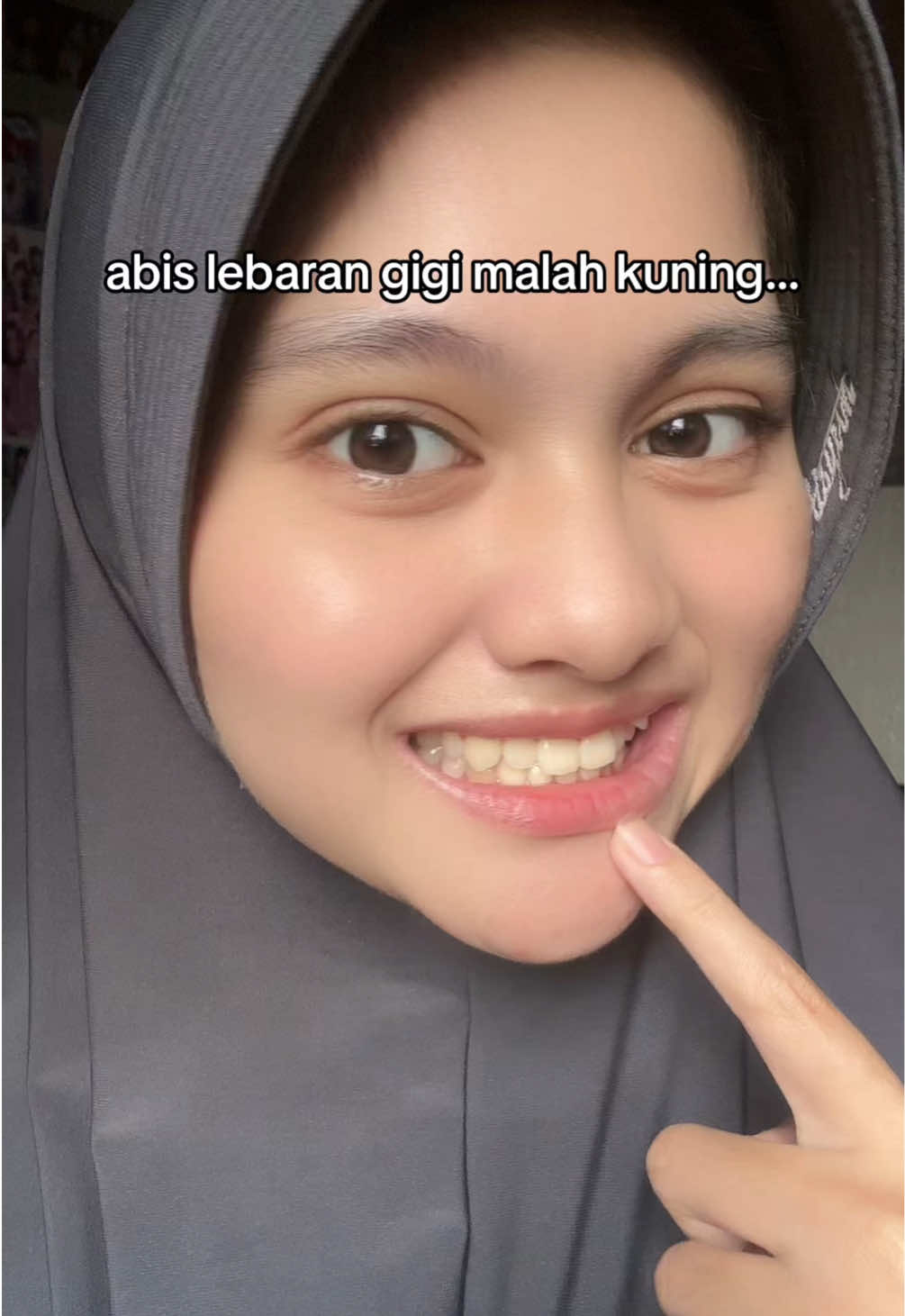 @ecaa
