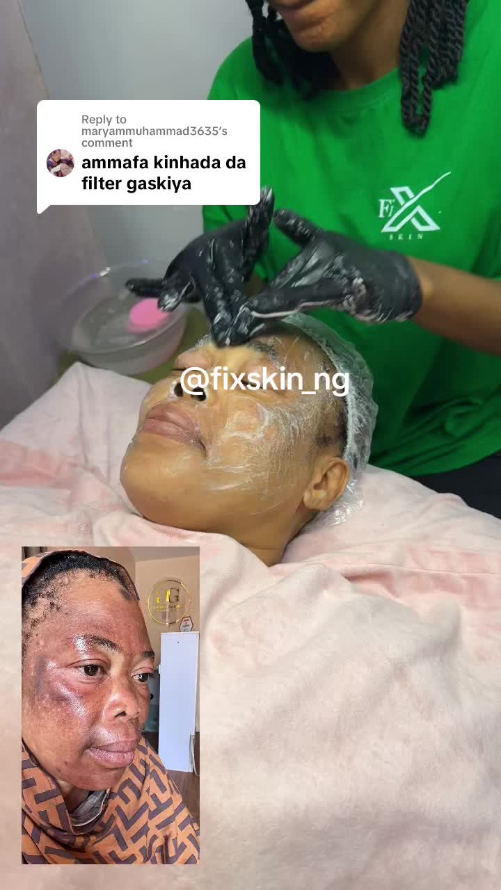 @FIX SKIN NIGERIA