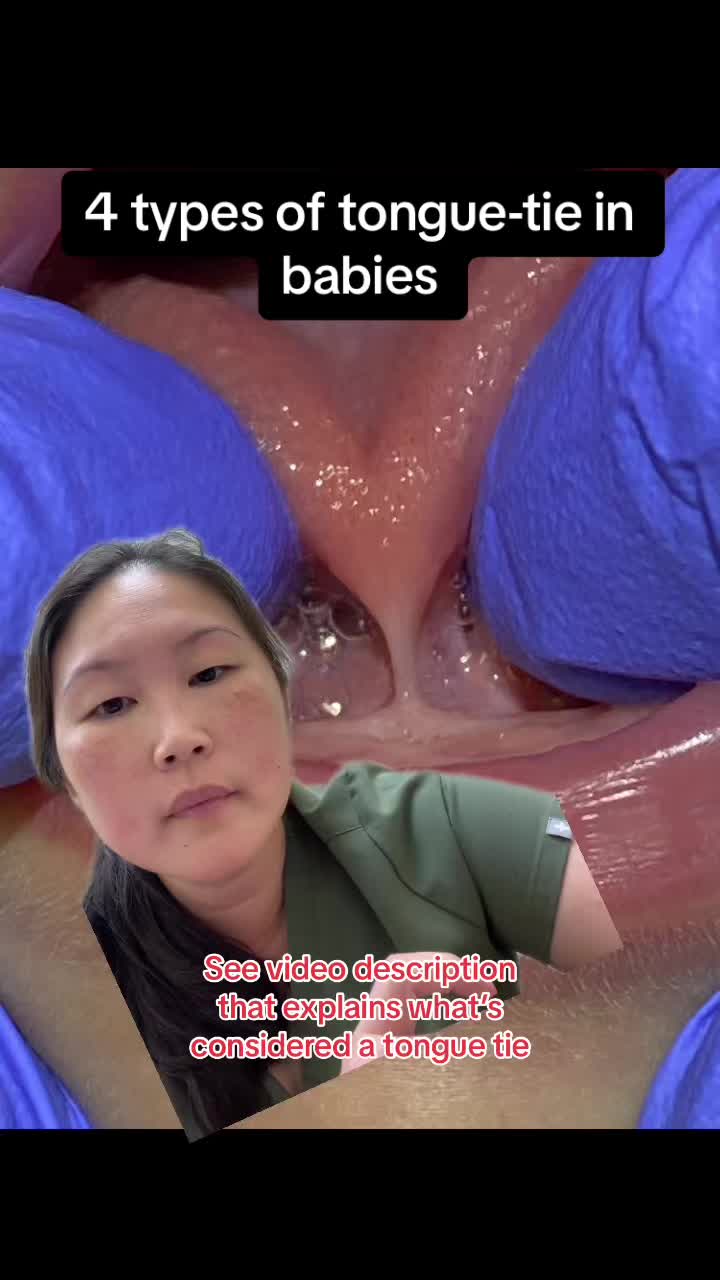 @Shirley Chan-Ramirez, MD IBCLC