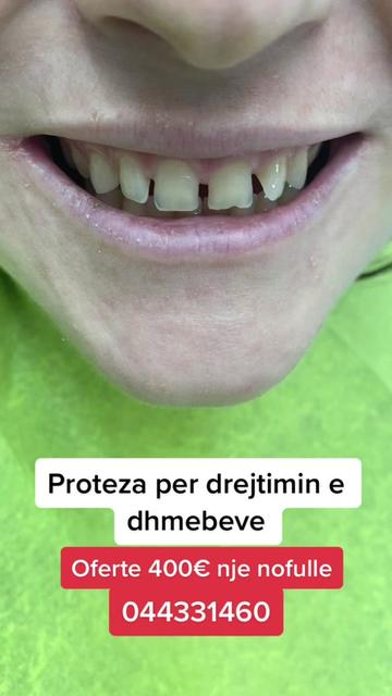 @sebi dent