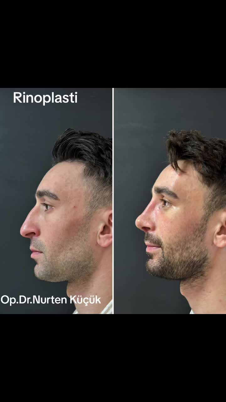 @Dr. NurtenKucuk