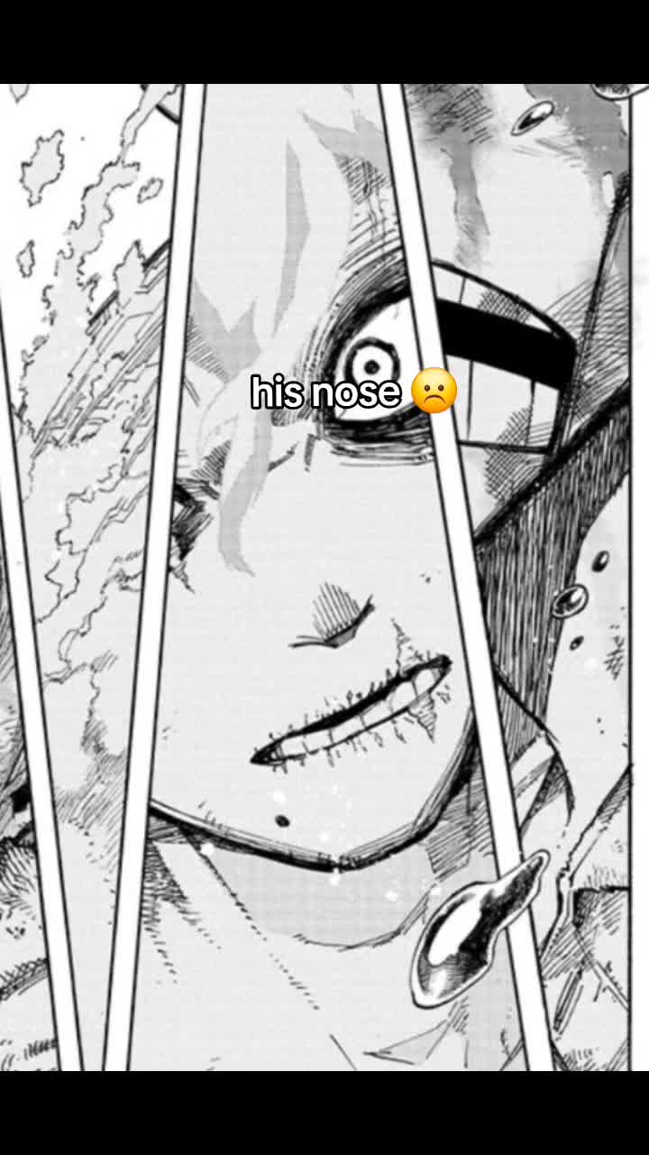 @shigaraki creep