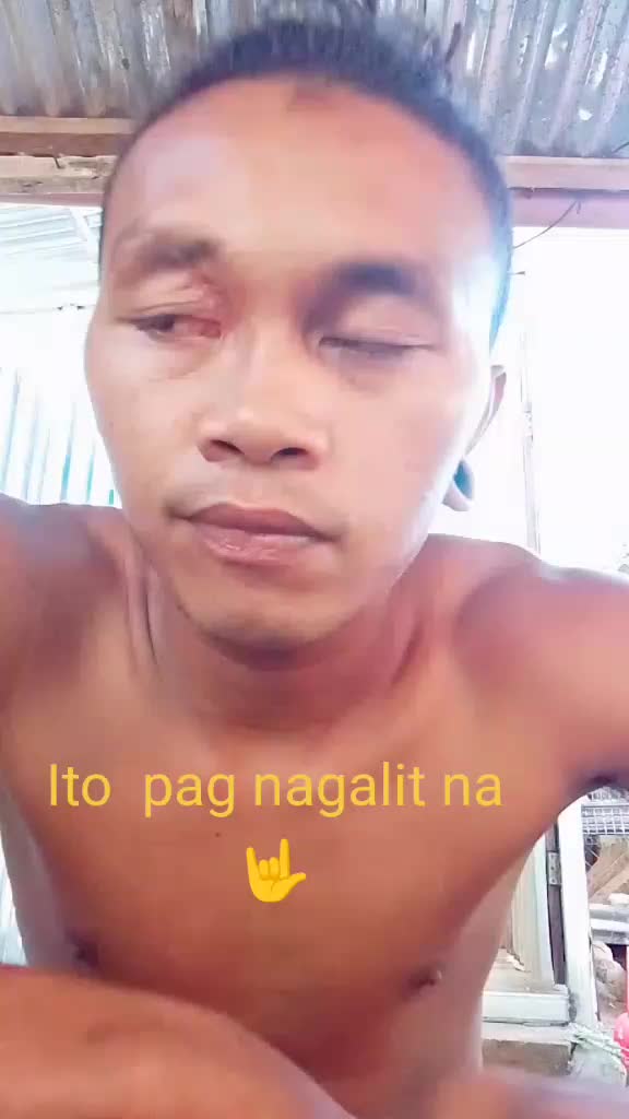 @Aldwin Alogan