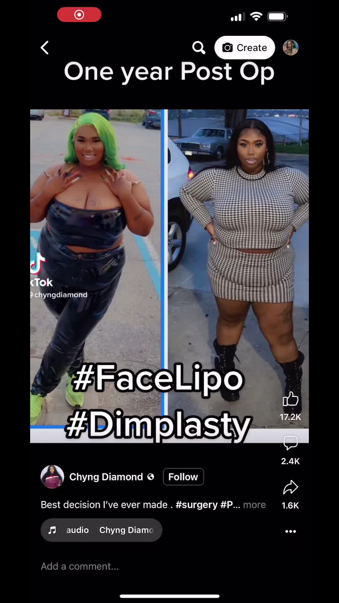 @GinoGTG
